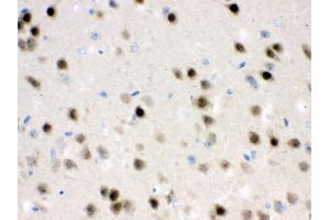 Anti- HDAC11 Picoband antibody,IHC(P) IHC(P): Mouse Brain Tissue (HDAC11 Antikörper  (N-Term))