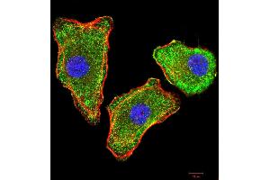 Immunocytochemistry (ICC) image for anti-Transthyretin (TTR) (AA 1-147) antibody (ABIN5875576) (TTR Antikörper  (AA 1-147))