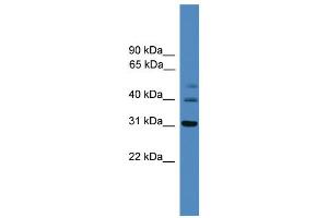 WB Suggested Anti-TRIB1  Antibody Titration: 0. (TRIB1 Antikörper  (C-Term))