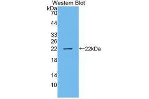 Western blot analysis of recombinant Cow IL18.