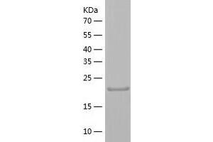 THAP3 Protein (AA 1-239) (His tag)