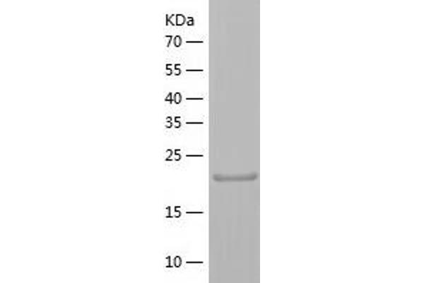 THAP3 Protein (AA 1-239) (His tag)