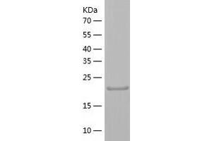 Western Blotting (WB) image for THAP Domain Containing, Apoptosis Associated Protein 3 (THAP3) (AA 1-239) protein (His tag) (ABIN7125351) (THAP3 Protein (AA 1-239) (His tag))