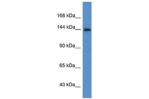 Western Blot showing Insr antibody used at a concentration of 1. (Insulin Receptor Antikörper  (Middle Region))