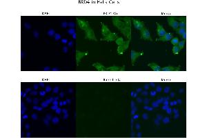 Sample Type :  HeLa   Primary Antibody Dilution:  4 ug/ml   Secondary Antibody :  Anti-rabbit Alexa 546   Secondary Antibody Dilution:  2 ug/ml   Gene Name :  BRD4 (BRD4 Antikörper  (C-Term))