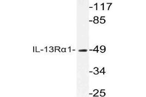 Western blot analysis of CD213a1 / IL13RA1 Antibody in extracts from COLOcells. (IL13 Receptor alpha 1 Antikörper)