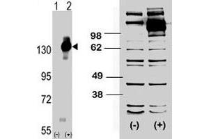 (LEFT) Western blot analysis of CSF1R (arrow) using rabbit CSF1R polyclonal antibody . (CSF1R Antikörper  (C-Term))