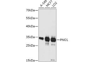 Western blot analysis of extracts of various cell lines, using PNO1 antibody (ABIN7269180) at 1:1000 dilution. (PNO1 Antikörper  (AA 1-252))
