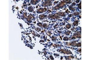 Immunohistochemical staining of paraffin-embedded Human breast tissue using anti-KHK mouse monoclonal antibody. (Ketohexokinase Antikörper)