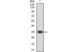 Western blot analysis using CD268 mAb against human CD268 (AA: extra 1-78) recombinant protein. (TNFRSF13C Antikörper  (AA 1-78))