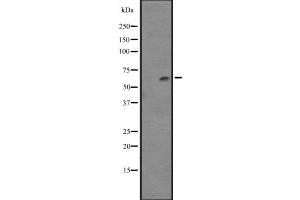 Western blot analysis of Cytochrome P450 4F12 expression in NCI-H460 cell line lysates ,The lane on the left is treated with the antigen-specific peptide.
