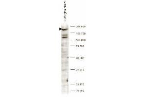 Western blot analysis is shown using anti-Huntingtin pS421 antibody to detect endogenous protein present in an unstimulated human PC-3 whole cell lysate (arrowhead). (Huntingtin Antikörper  (pSer421))