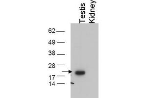 Image no. 1 for anti-Glutathione Peroxidase 4 (GPX4) (C-Term) antibody (ABIN401375)