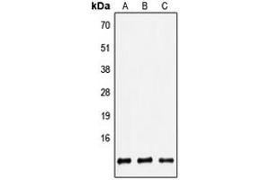 Western blot analysis of Defensin beta 2 expression in HEK293T (A), Raw264. (beta 2 Defensin Antikörper  (Center))