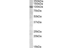 ABIN2564625 (1µg/ml) staining of HeLa lysate (35µg protein in RIPA buffer). (PKD2 Antikörper  (Internal Region))