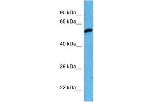 Host:  Mouse  Target Name:  DES  Sample Tissue:  Mouse Testis  Antibody Dilution:  1ug/ml (Desmin Antikörper  (Middle Region))
