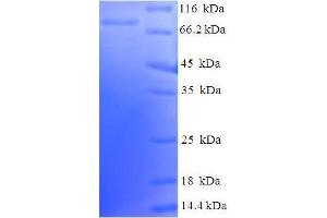SDS-PAGE (SDS) image for Lymphocyte-Specific Protein tyrosine Kinase (LCK) (AA 1-539), (Isoform 3) protein (His-SUMO Tag) (ABIN5709839) (LCK Protein (AA 1-539, Isoform 3) (His-SUMO Tag))