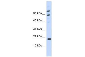 Western Blotting (WB) image for anti-BRWD1-AS2 antibody (ABIN2458959)