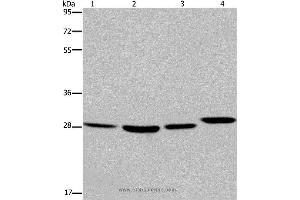 Western blot analysis of 293T and LoVo cell, mouse skin tissue and A172 cell, using ETV7 Polyclonal Antibody at dilution of 1:850 (ETV7 Antikörper)