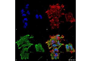 Immunocytochemistry/Immunofluorescence analysis using Mouse Anti-Alpha B Crystallin Monoclonal Antibody, Clone 3A10. (CRYAB Antikörper  (HRP))