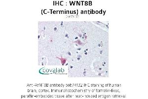 Image no. 1 for anti-Wingless-Type MMTV Integration Site Family, Member 8B (WNT8B) (C-Term) antibody (ABIN1740841) (WNT8B Antikörper  (C-Term))