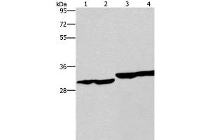 Western Blot analysis of Human endometrial carcinoma and colon cancer tissue, Human fetal liver tissue and PC3 cell using DECR1 Polyclonal Antibody at dilution of 1:300 (DECR1 Antikörper)