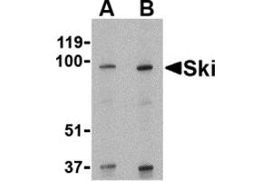 Western Blotting (WB) image for anti-SKI Proto-Oncogene (SKI) (N-Term) antibody (ABIN1031573) (SKI Antikörper  (N-Term))