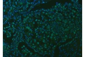 IF analysis of SNRPA1 using anti-SNRPA1 antibody (ABIN7599131). (SNRPA1 Antikörper  (AA 1-233))