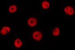 ABIN6277195 staining HepG2 by IF/ICC.