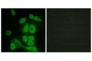 Immunofluorescence analysis of A549 cells, using FXR2 antibody. (FXR2 Antikörper)