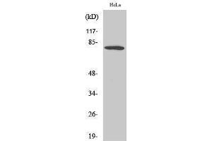 Western Blotting (WB) image for anti-Forkhead Box O1 (FOXO1) (Ser38) antibody (ABIN3184664) (FOXO1 Antikörper  (Ser38))