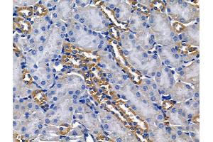 ABIN6260962 and ABIN6268678 at 1/100 staining Mouse brain tissue by IHC-P.