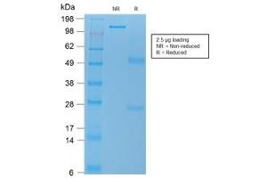 SDS-PAGE analysis of purified, BSA-free recombinant TL1A antibody (clone rVEGI/1283) as confirmation of integrity and purity. (TNFSF15 Antikörper)