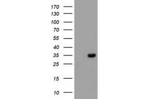 HEK293T cells were transfected with the pCMV6-ENTRY control (Left lane) or pCMV6-ENTRY MYD88 (Right lane) cDNA for 48 hrs and lysed. (MYD88 Antikörper)