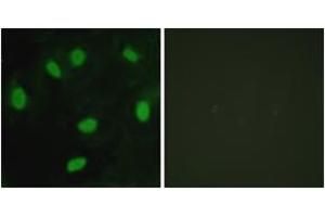 Immunofluorescence analysis of HeLa cells, using TBX15/18 Antibody. (T-Box 15/18 Antikörper  (AA 161-210))