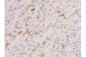 DAB staining on IHC-P; Samples: Human Spleen Tissue (Caspase 1 Antikörper  (AA 120-297))