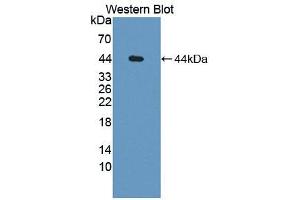 Western blot analysis of the recombinant protein. (Complement Factor H Antikörper  (AA 879-1236))