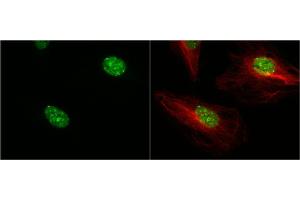 ICC/IF Image 53BP1 antibody [N1], N-term detects 53BP1 protein at nucleus by immunofluorescent analysis.