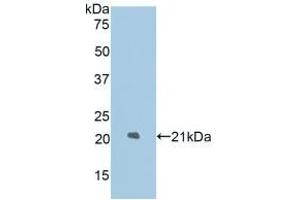 Detection of Recombinant LAMP2, Rat using Polyclonal Antibody to Lysosomal Associated Membrane Protein 2 (LAMP2) (LAMP2 Antikörper  (AA 191-362))