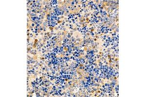 Immunohistochemistry (Paraffin-embedded Sections) (IHC (p)) image for anti-Tumor Necrosis Factor Receptor Superfamily, Member 8 (TNFRSF8) antibody (ABIN7076073)