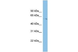 WB Suggested Anti-TINAGL1 Antibody Titration: 0. (TINAGL1 Antikörper  (Middle Region))