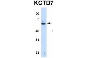 Host:  Rabbit  Target Name:  KCTD7  Sample Type:  Human Fetal Lung  Antibody Dilution:  1. (KCTD7 Antikörper  (N-Term))