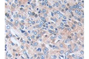 Immunohistochemistry (IHC) image for anti-serpin Peptidase Inhibitor, Clade B (Ovalbumin), Member 9 (SERPINB9) (AA 1-376) antibody (ABIN7435502)