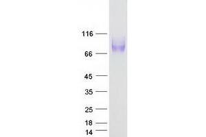 Western Blotting (WB) image for Lysosomal-Associated Membrane Protein 1 (LAMP1) protein (Myc-DYKDDDDK Tag) (ABIN2713363)