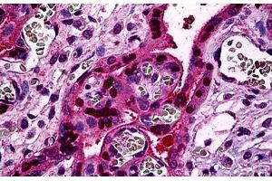 Human Placenta: Formalin-Fixed, Paraffin-Embedded (FFPE) (STAT5B Antikörper  (AA 678-788))