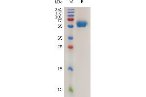 SDS-PAGE (SDS) image for Receptor Tyrosine Kinase-Like Orphan Receptor 1 (ROR1) (AA 30-403) protein (His tag) (ABIN7491137)