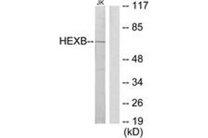 Western Blotting (WB) image for anti-Hexosaminidase B (Beta Polypeptide) (HEXB) (AA 481-530) antibody (ABIN2879138) (HEXB Antikörper  (AA 481-530))