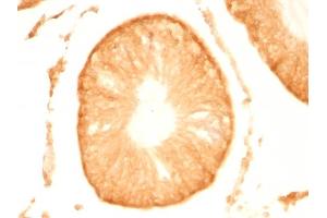 Formalin-fixed, paraffin-embedded Rat Testis stained with Pgp9. (UCHL1 Antikörper)