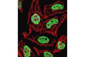 Immunofluorescence (IF) image for anti-Kruppel-Like Factor 6 (KLF6) antibody (ABIN3002701) (KLF6 Antikörper)