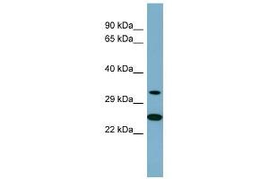 PRKAB2 antibody used at 1 ug/ml to detect target protein.